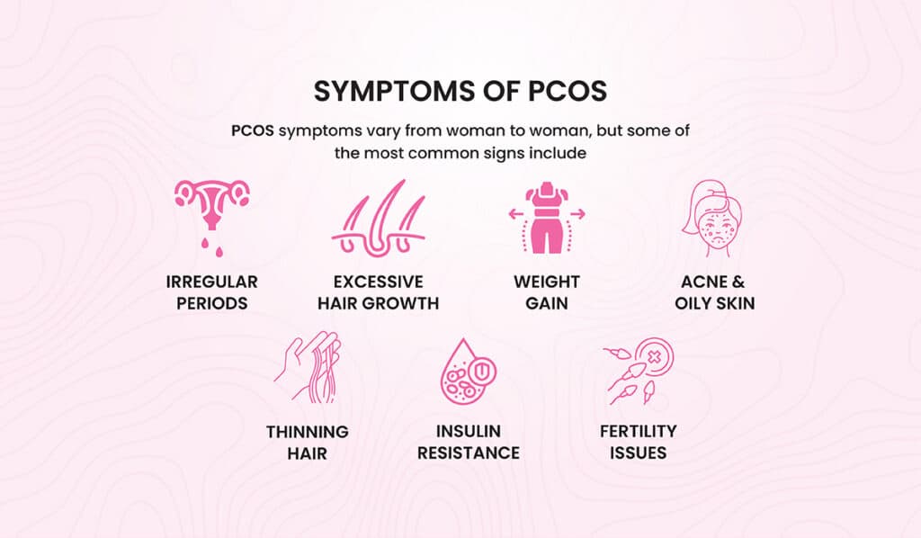 PCOS Explained: What Every Woman Should Know
